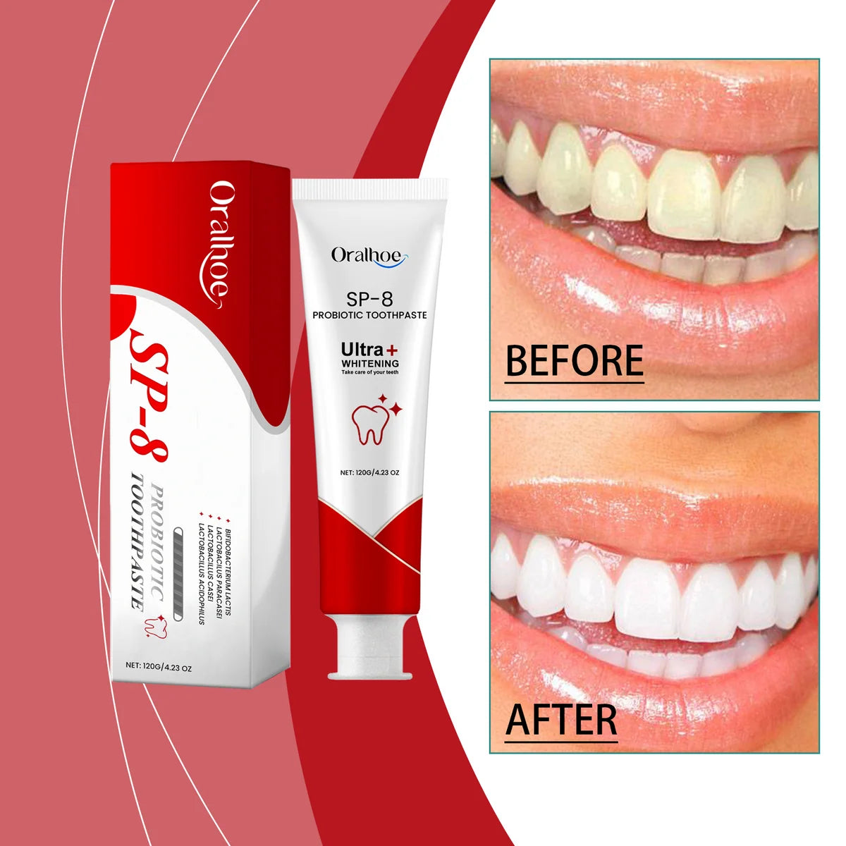 SP-8 Probiotic Dental Care Toothpaste