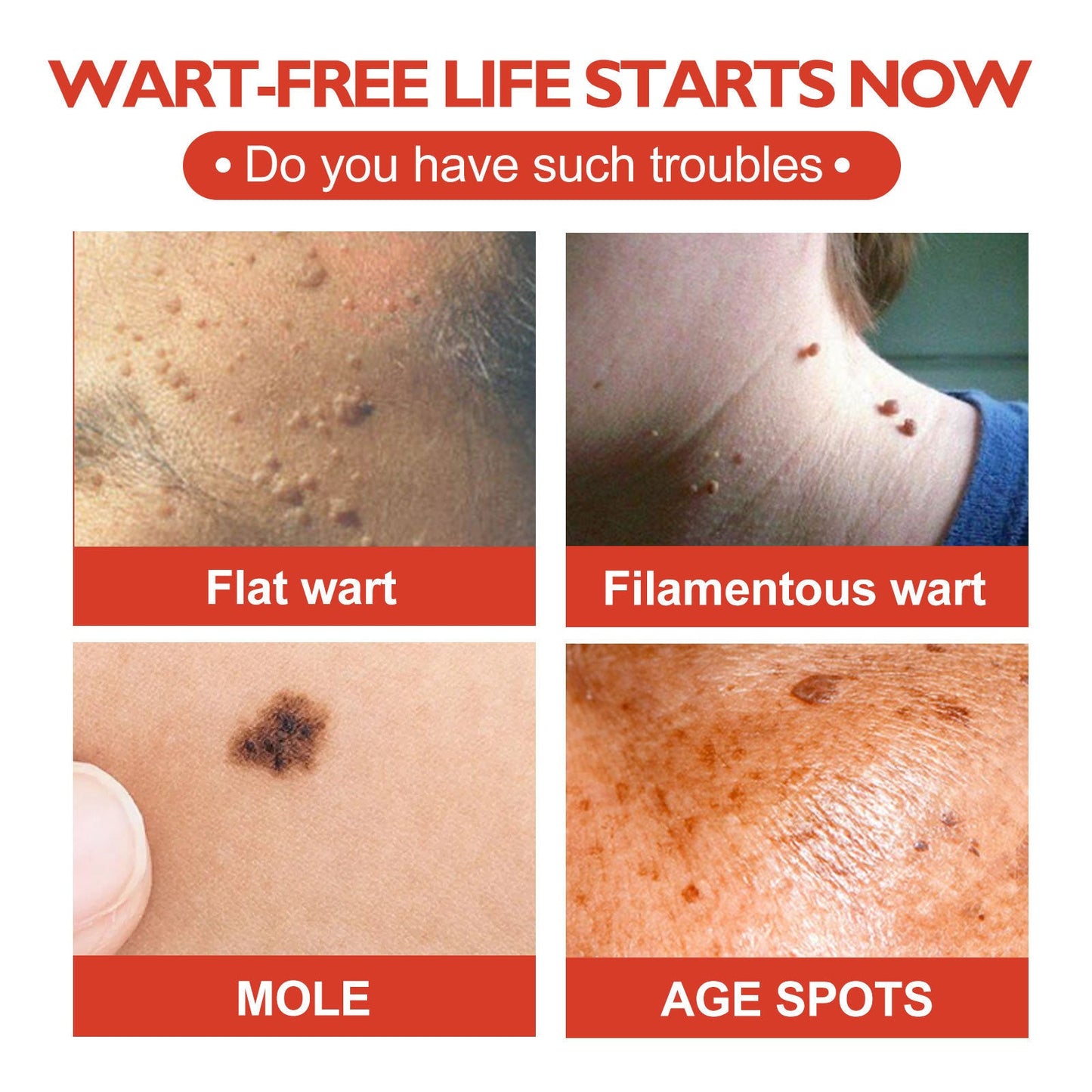 Acne Cleaning Fade Spots Acne Patch