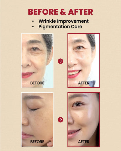 K‑SECRET - SEOUL 1988 Serum: Retinal Liposome 2% + Black Ginseng