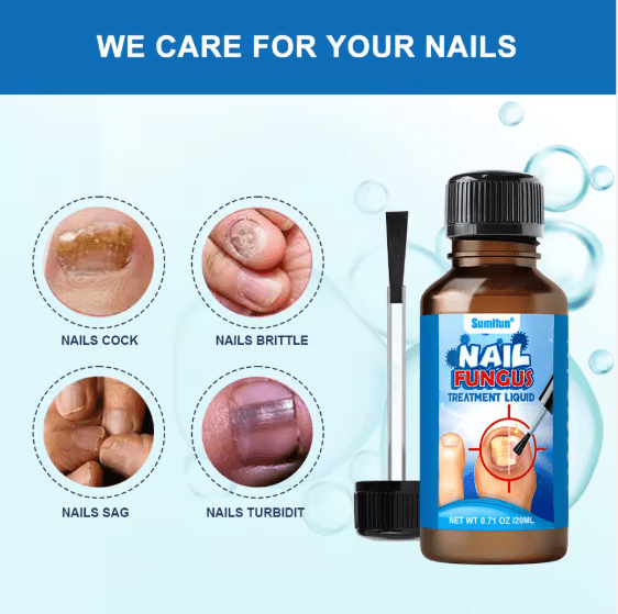Sumi fun - Nail Fungus Treatment Liquid