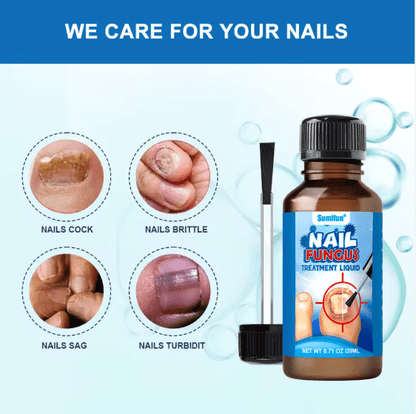 Sumi fun - Nail Fungus Treatment Liquid